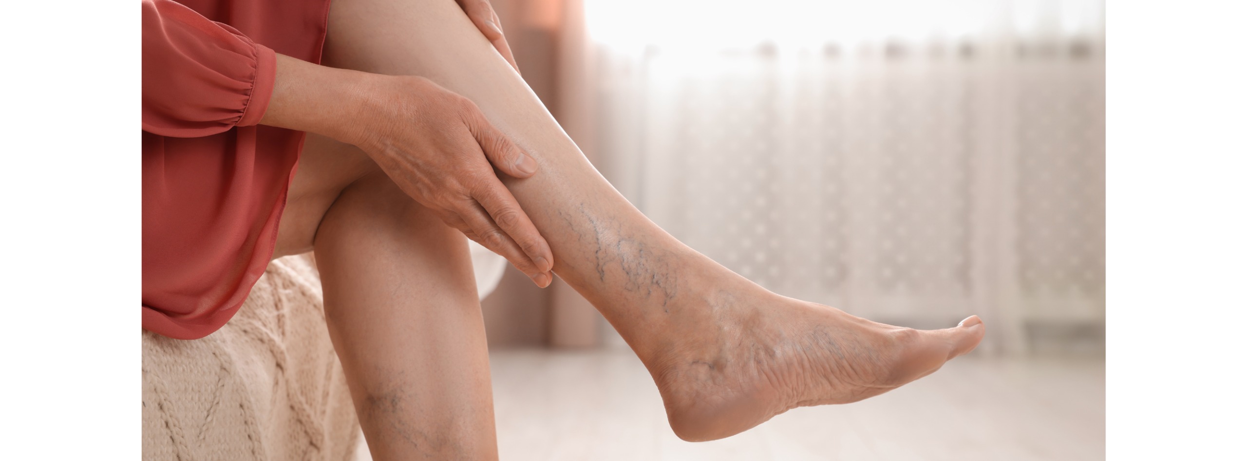Varicose Treatment